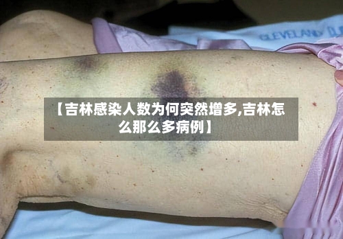 【吉林感染人数为何突然增多,吉林怎么那么多病例】-第1张图片