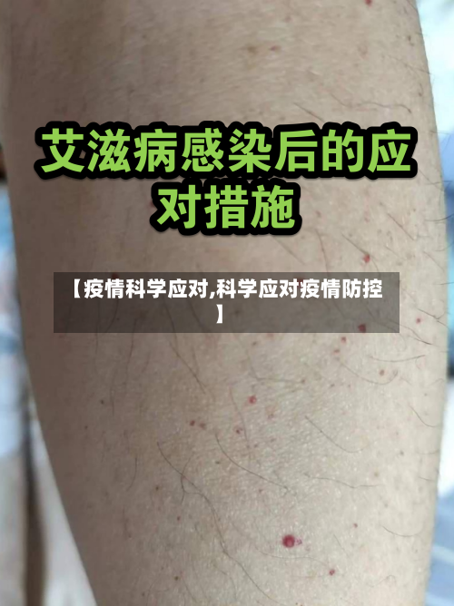 【疫情科学应对,科学应对疫情防控】-第1张图片