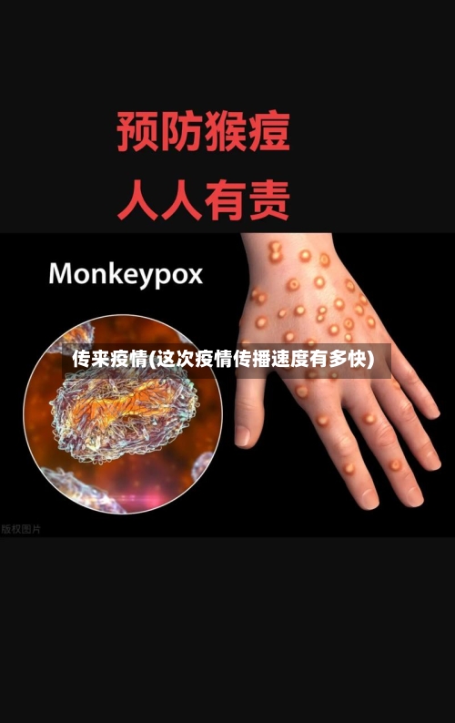 传来疫情(这次疫情传播速度有多快)-第1张图片